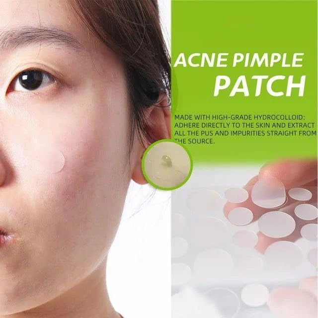 Acne pimple patch (72 pieces)