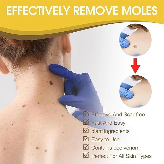 Bee Venom Treatment Cream (Pack of 2)