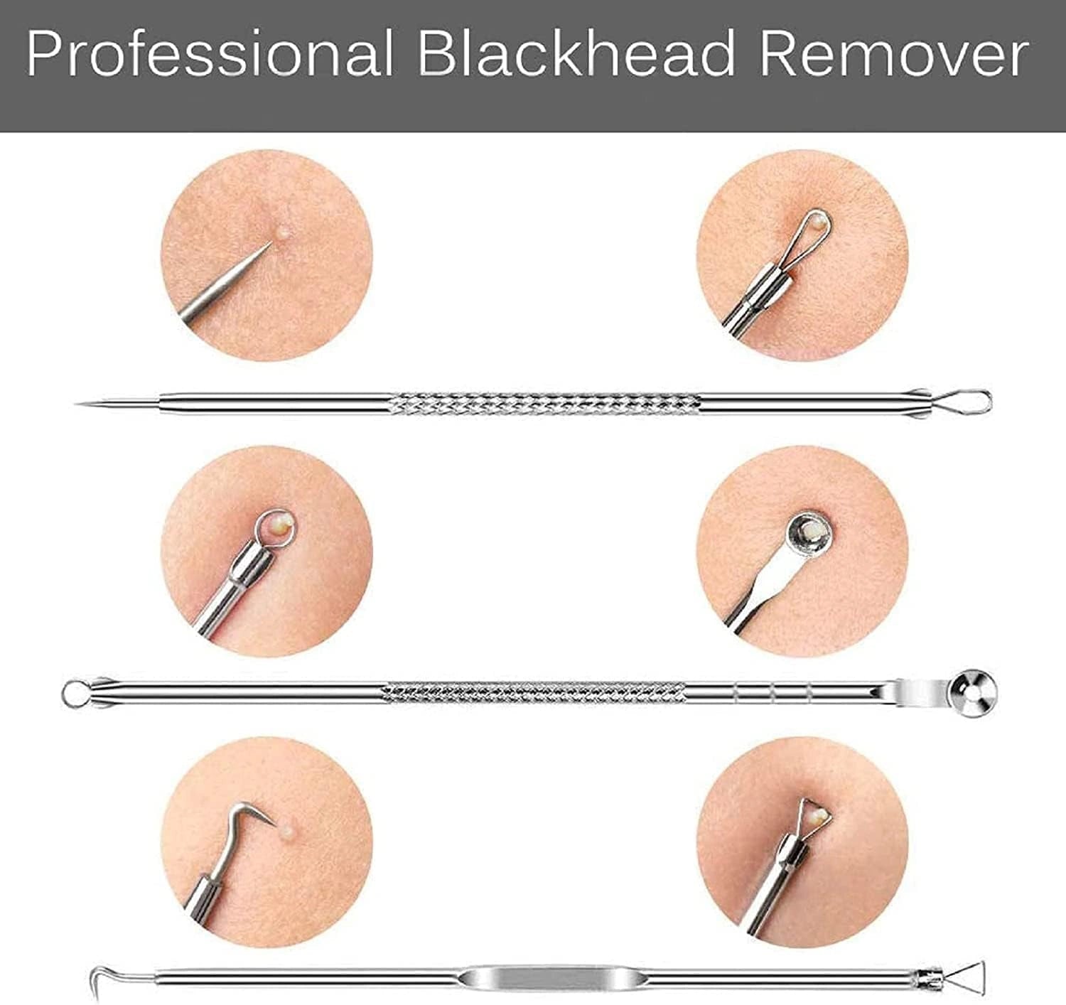 Blackhead remover tool set