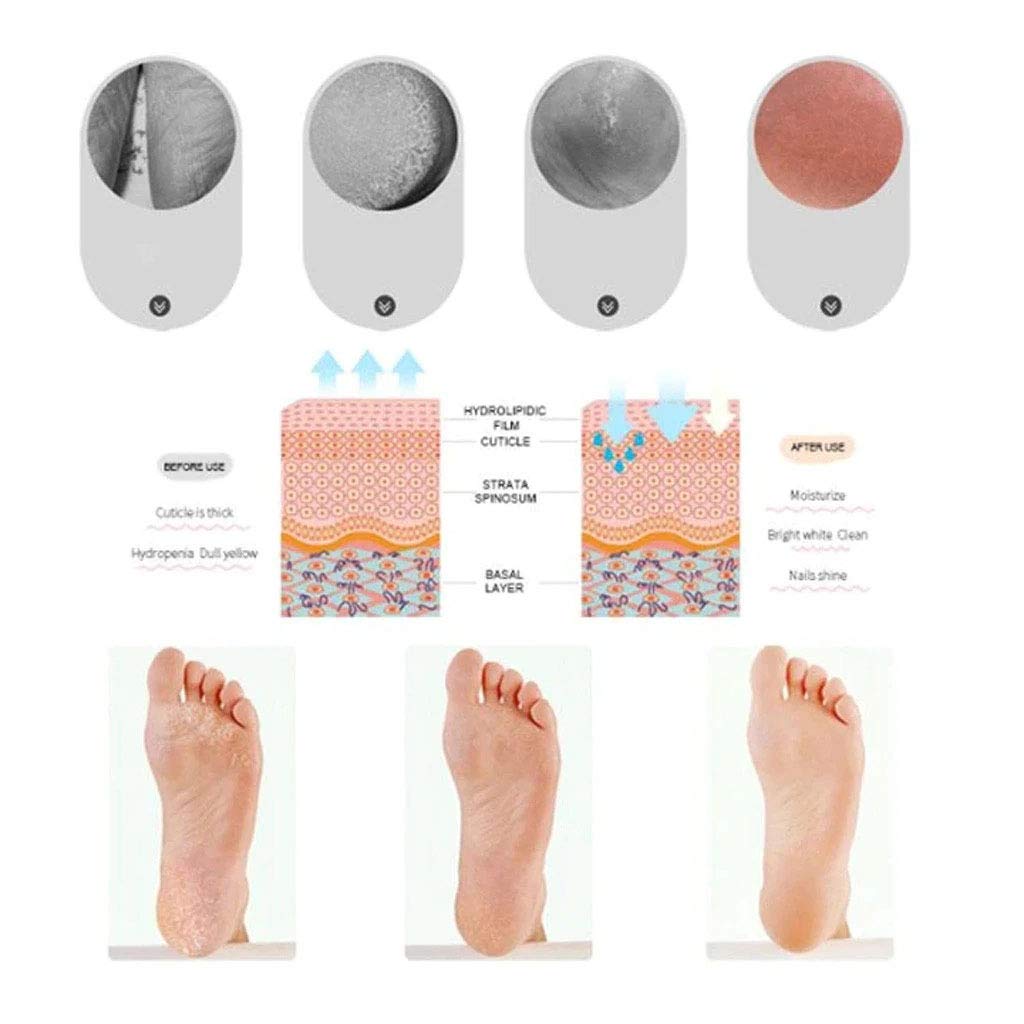 Cracked heel repair socks