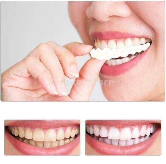 Teeth brace temporary braces cover