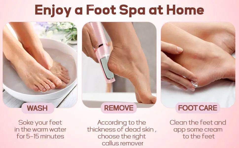 Electric callus remover tool