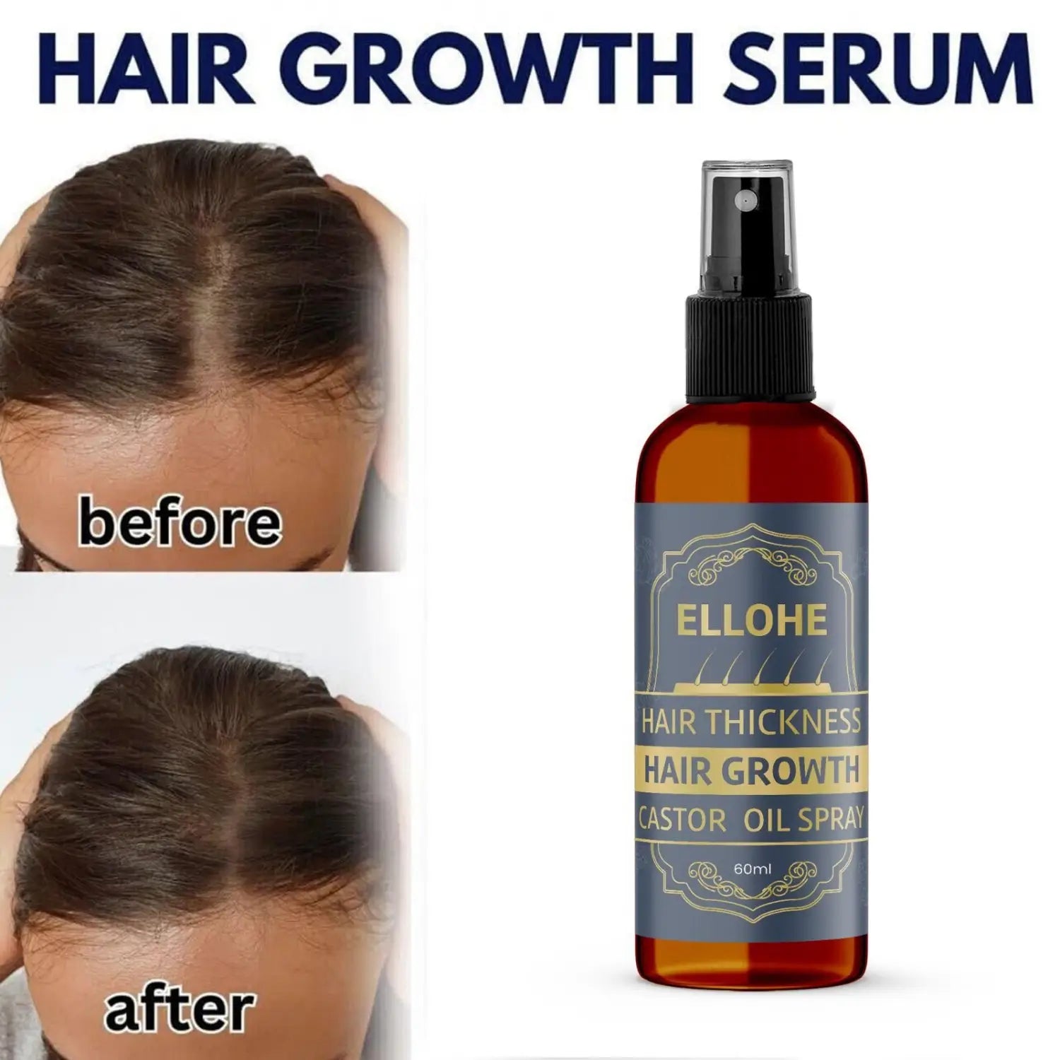 Ellohe hair thickness growth castor oil spray 120ml pack of 2