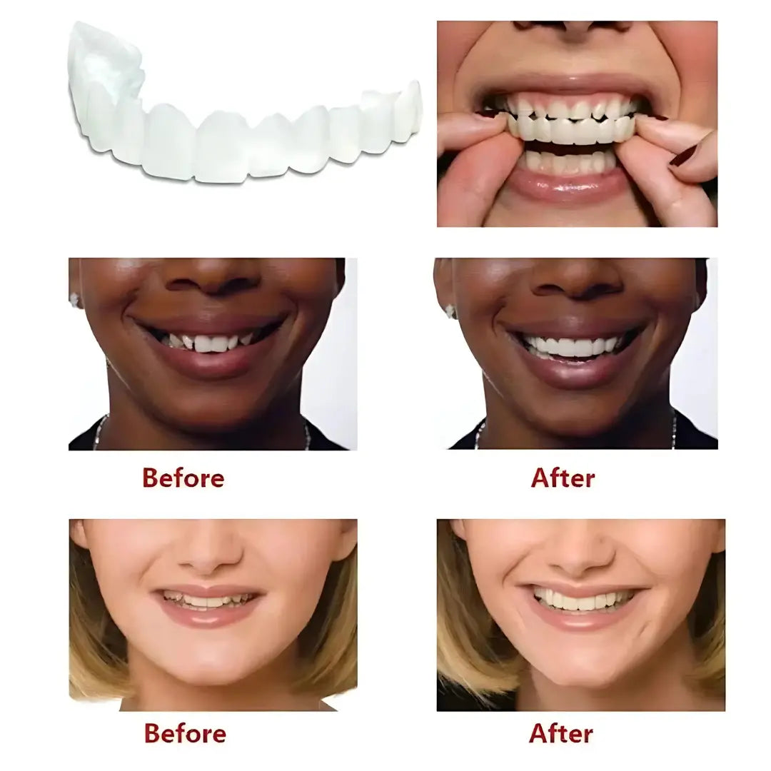 Advanced Cosmetic Teeth Denture