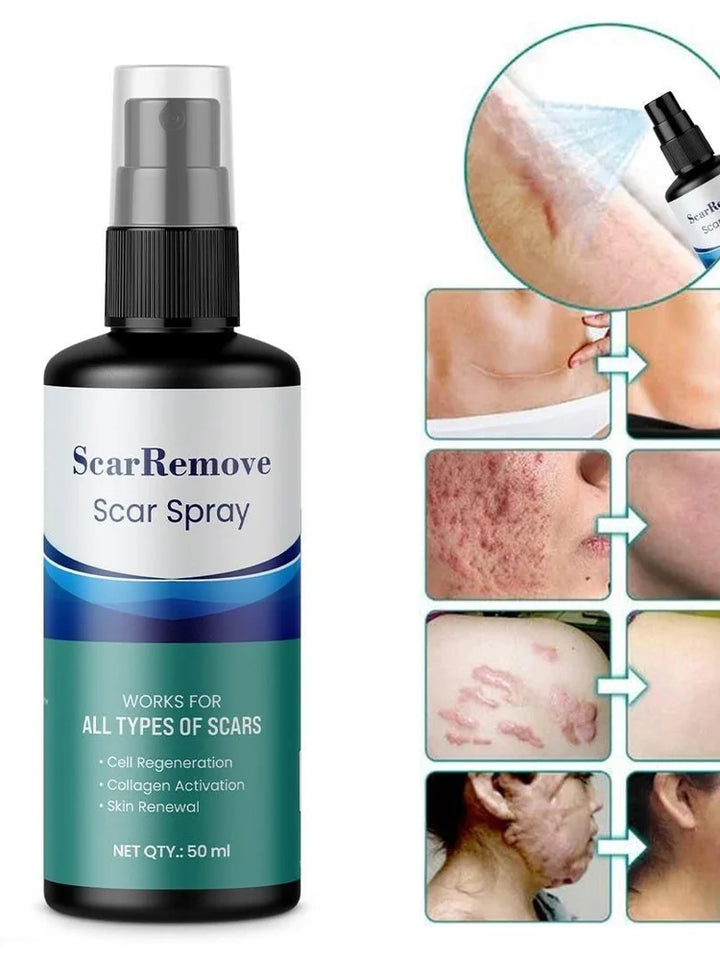 Scar Remover Spray – 100ml
