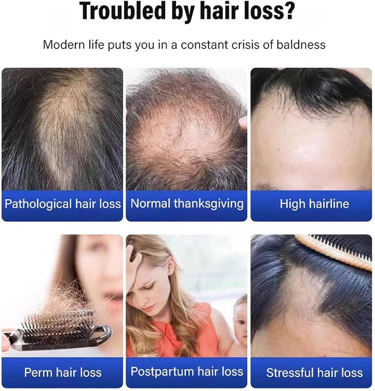 Anti hair loss shampoo 200ml (pack of 2)