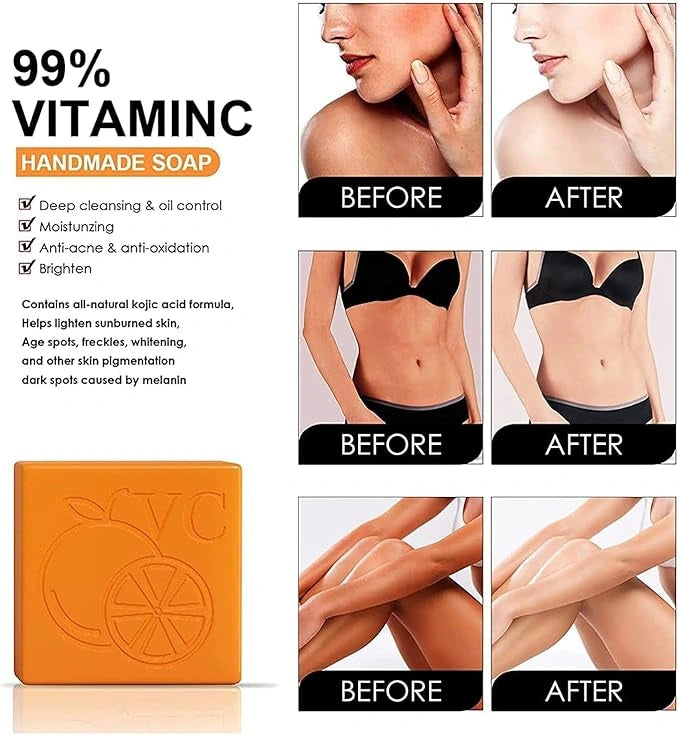 Orange vitamin c soap – 300g