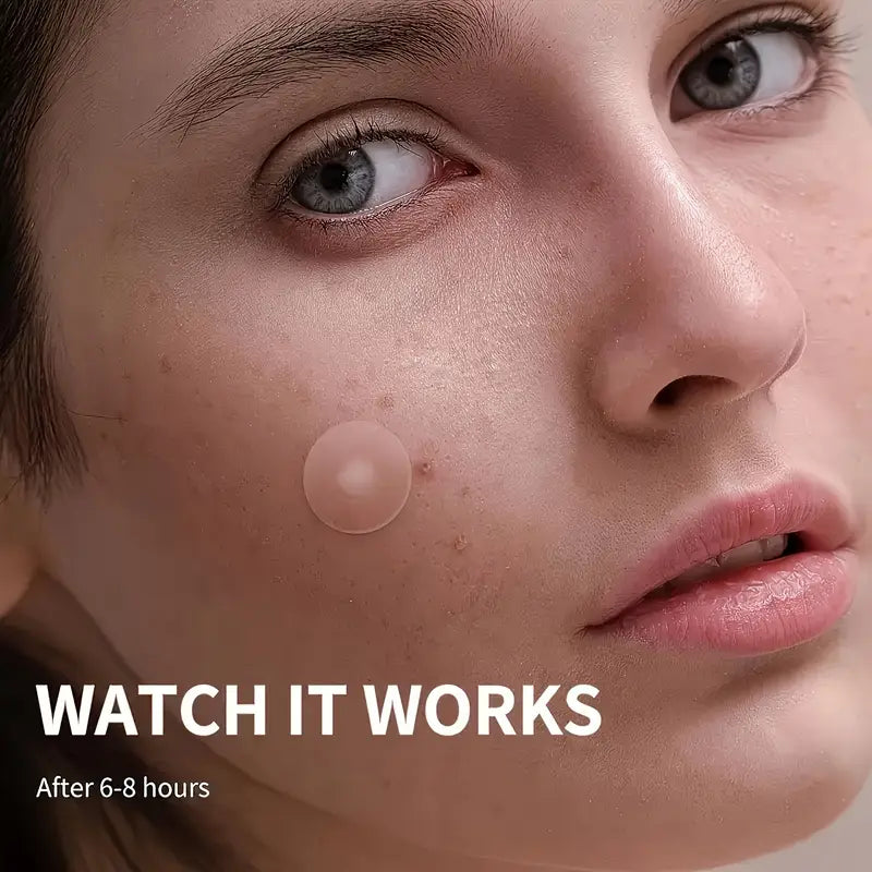 Overnight acne healing patches
