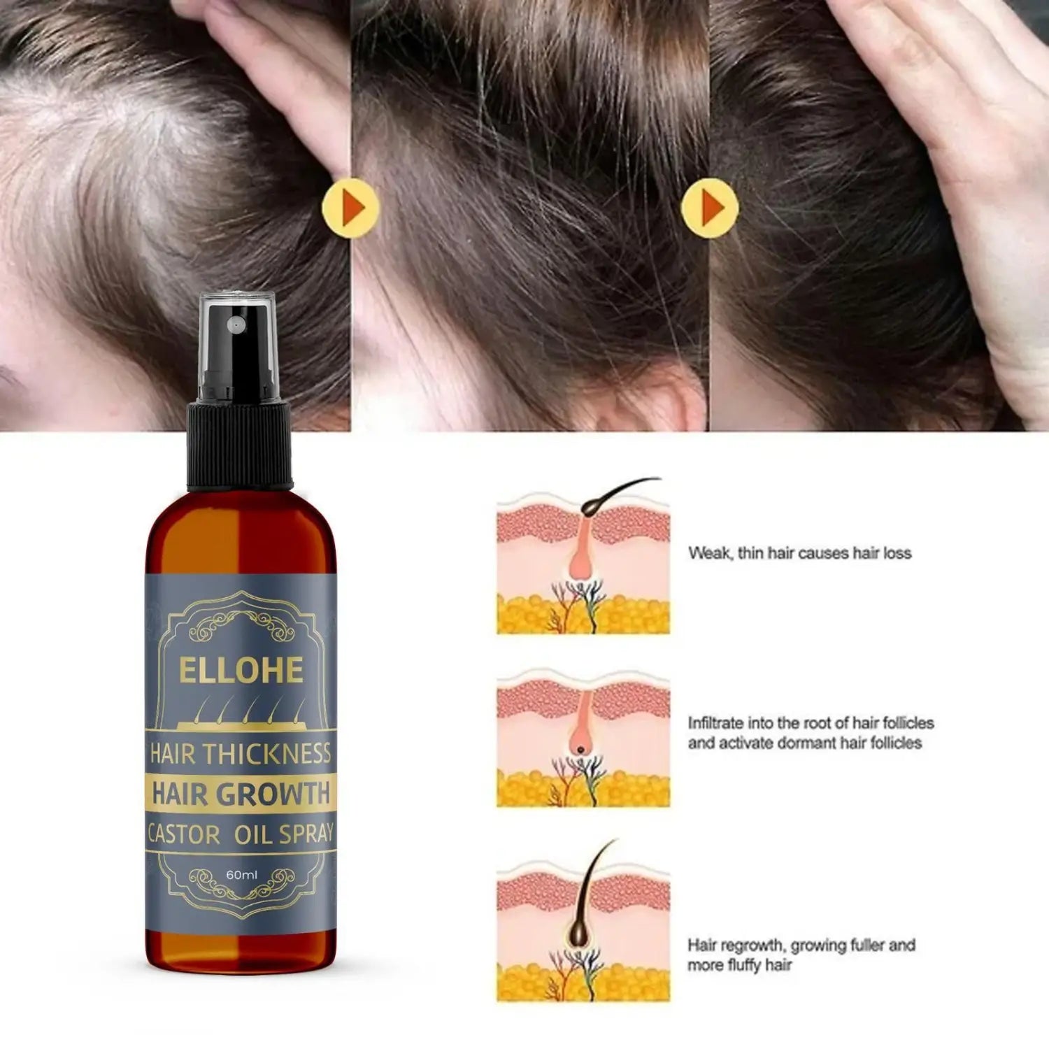 Ellohe hair thickness growth castor oil spray 120ml pack of 2