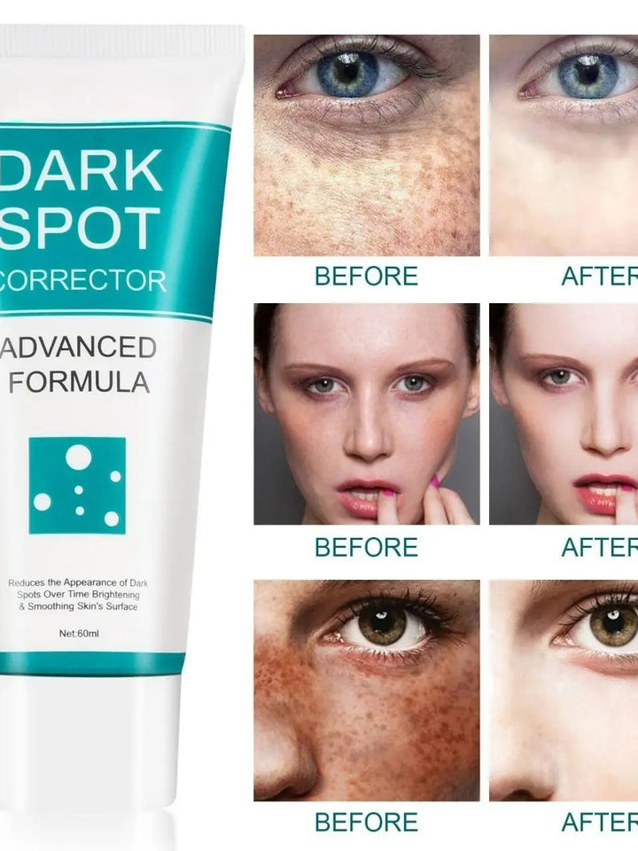 Dark Spot Correcting Cream