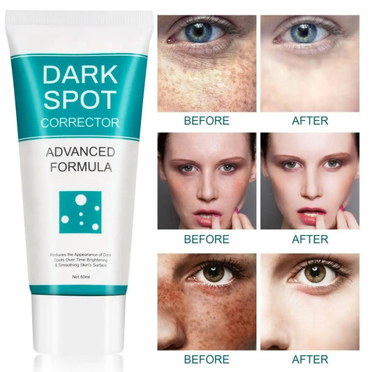 Dark Spot Correcting Cream