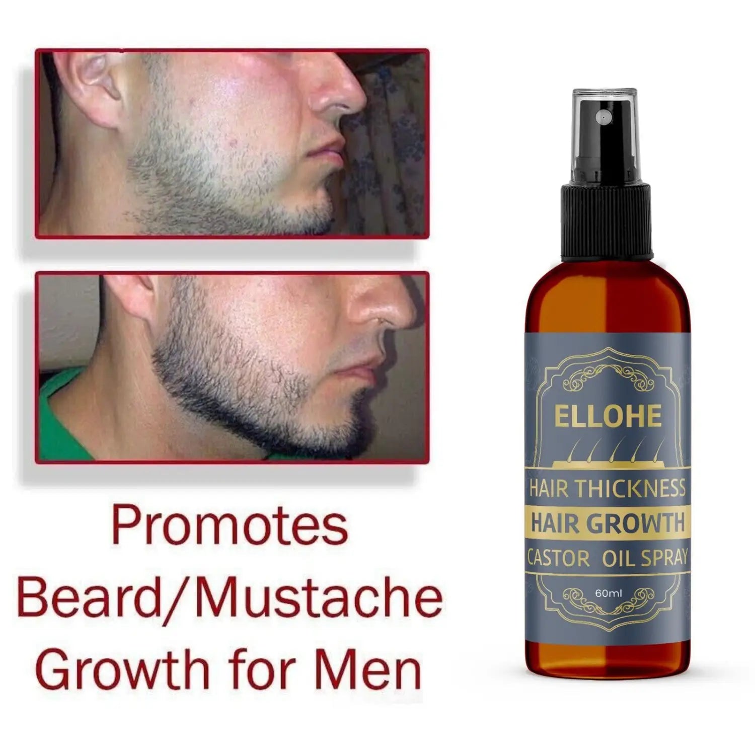 Ellohe hair thickness growth castor oil spray 120ml pack of 2