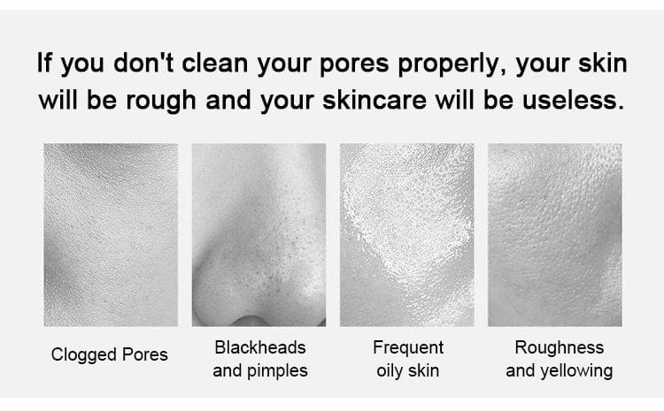 Gold peel off mask (buy 1 get free)