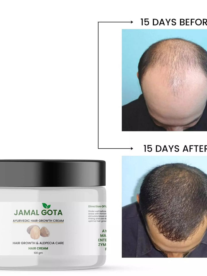 Jamalgota Hair Fall Control Cream