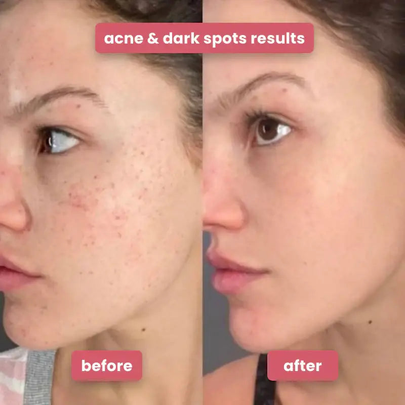 Turmeric kojic acid cleansing pads