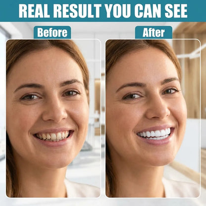 Advanced Cosmetic Teeth Denture (BUY 1 GET 1 FREE)