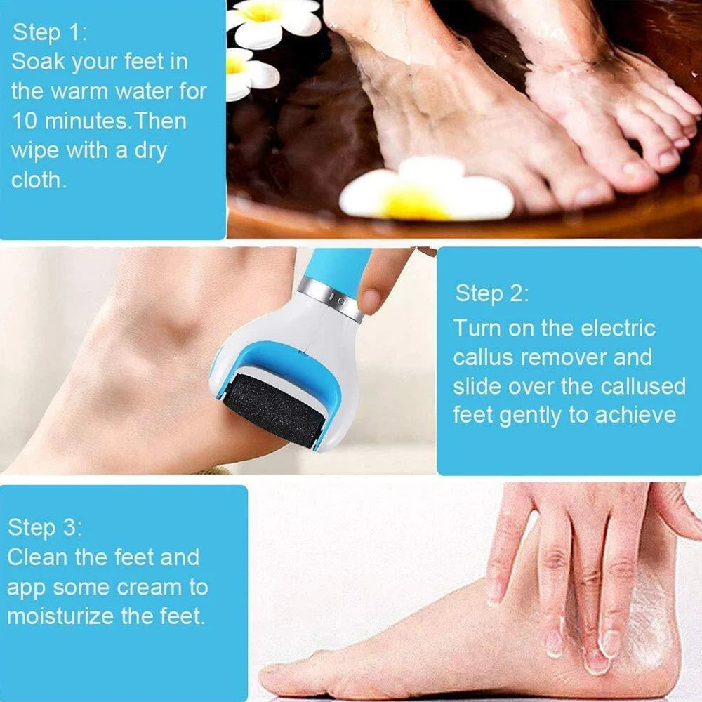 Electric callus remover for feet