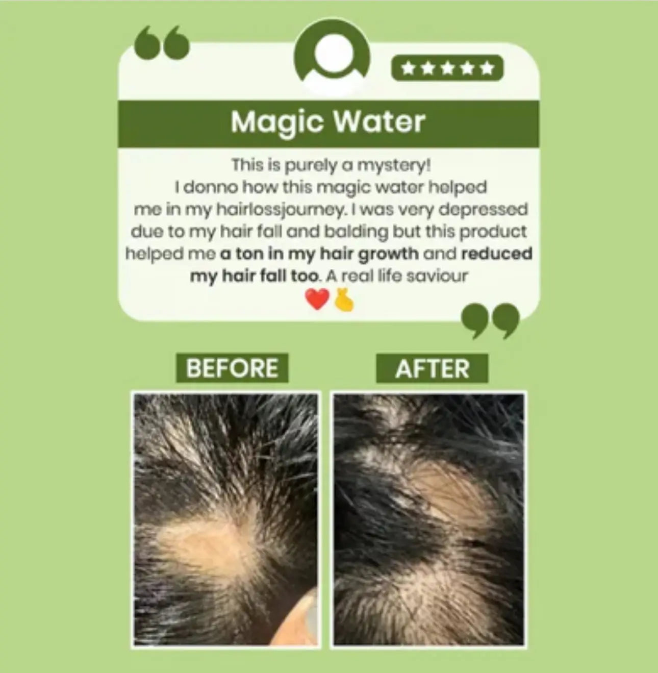 Rosemary water hair spray for regrowth (pack of 3)