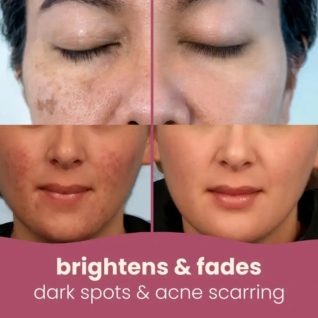 Turmeric kojic acid cleansing pads