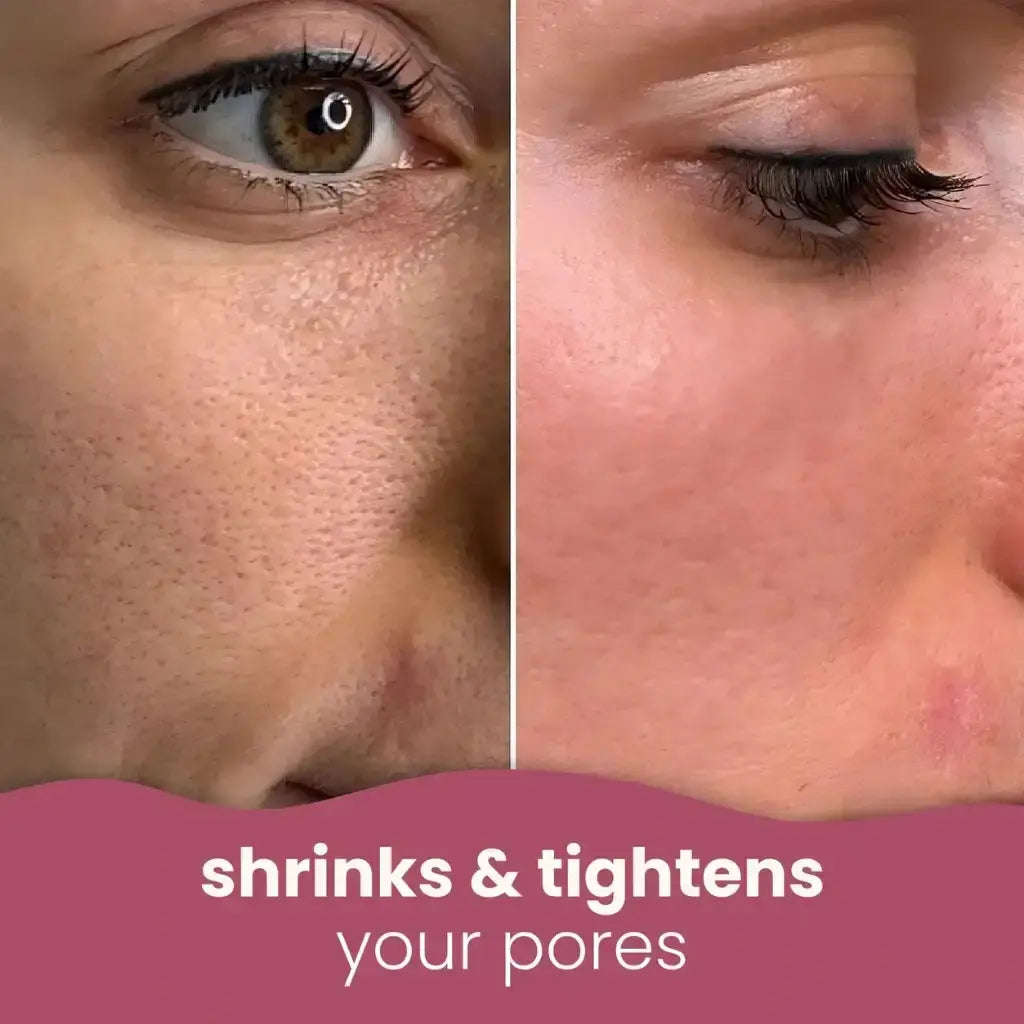 Turmeric kojic acid cleansing pads
