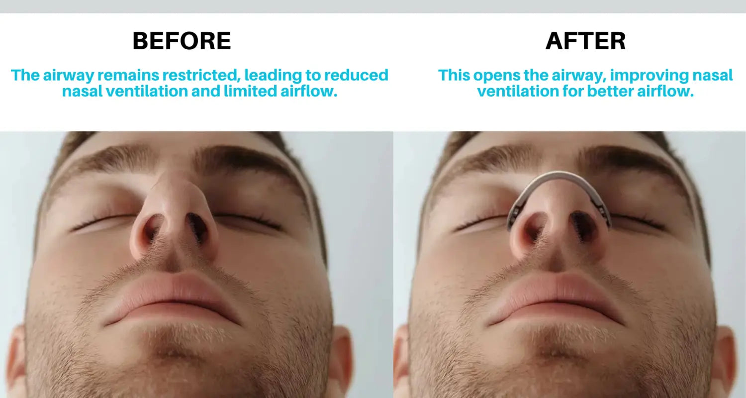 Magnetic nasal breathing strips