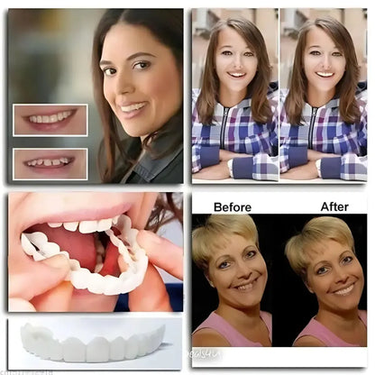 Advanced cosmetic teeth denture (buy 1 get free)