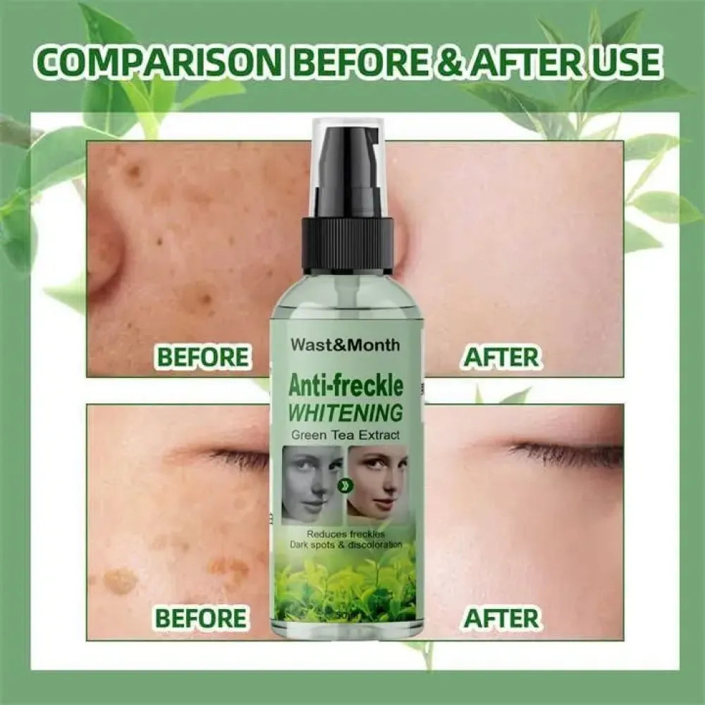 Anti-freckle green tea serum – 50ml (pack of 2)