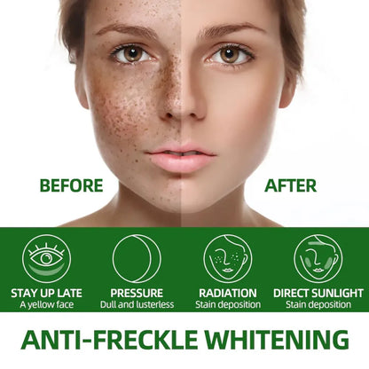 Anti-freckle green tea serum – 50ml (pack of 2)