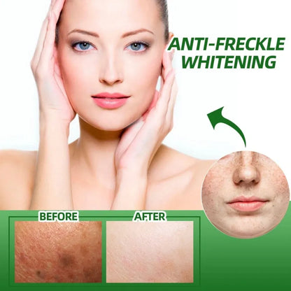 Anti-freckle green tea serum – 50ml (pack of 2)