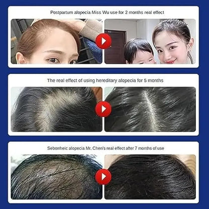 Anti hair loss shampoo 200ml (pack of 2)
