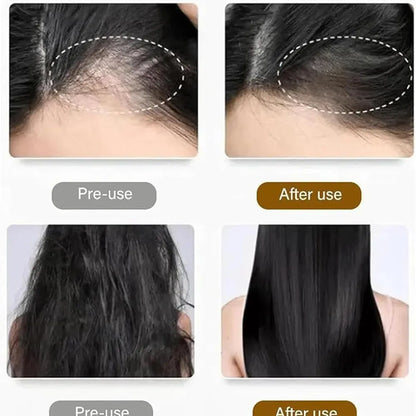 Anti hair loss shampoo 200ml (pack of 2)