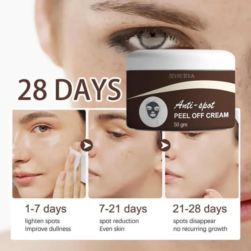 Anti-spot peel off cream