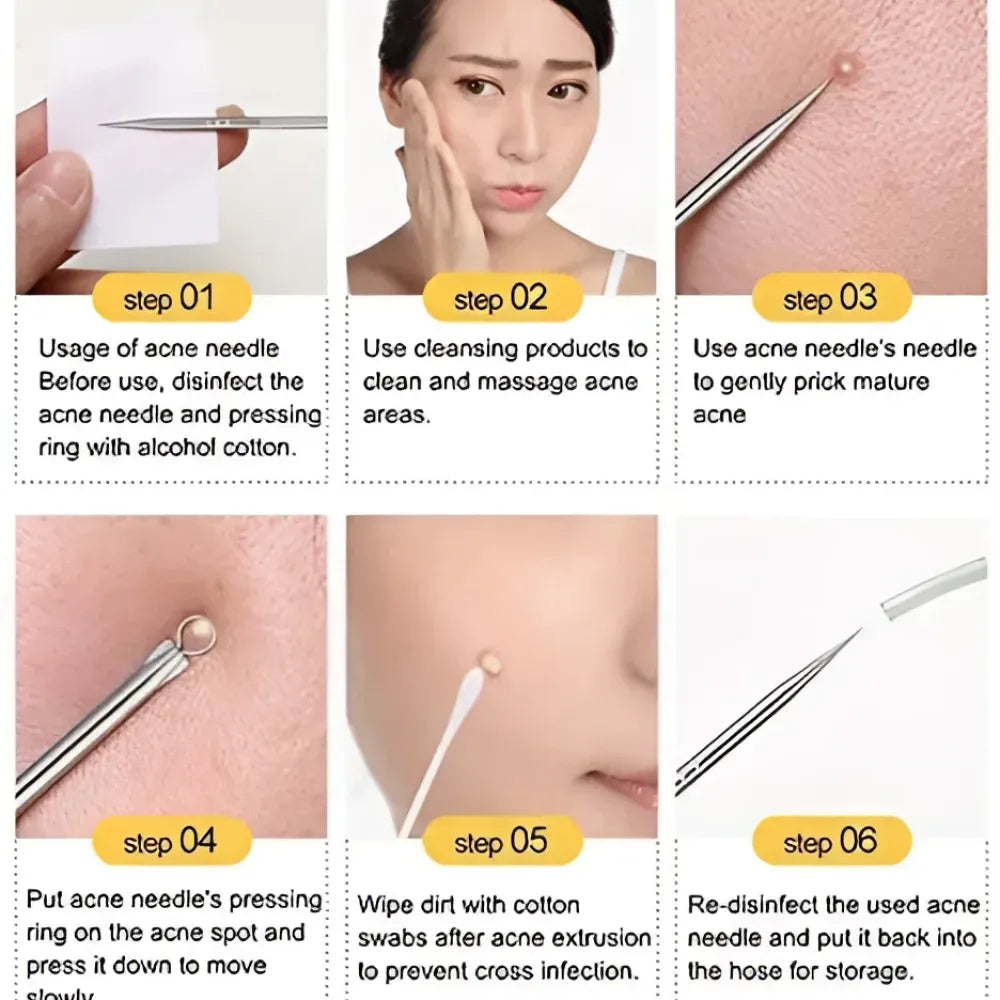 Blackhead remover tool set