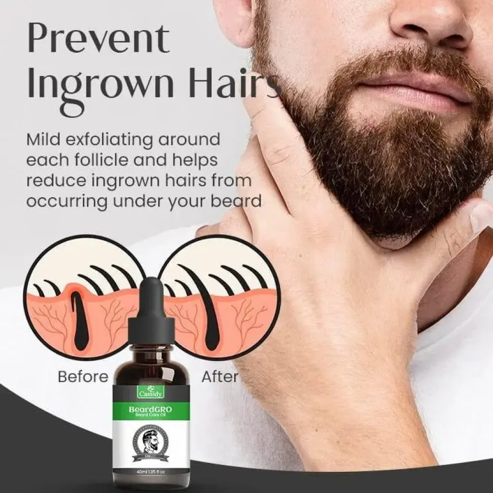 Cassidy beardgro beard oil (pack of 2)