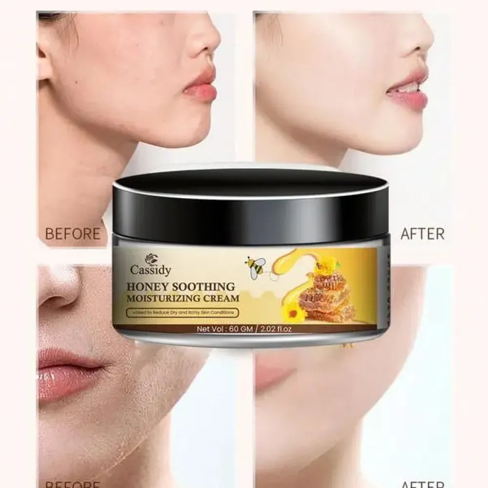 Cassidy honey moisturizing cream