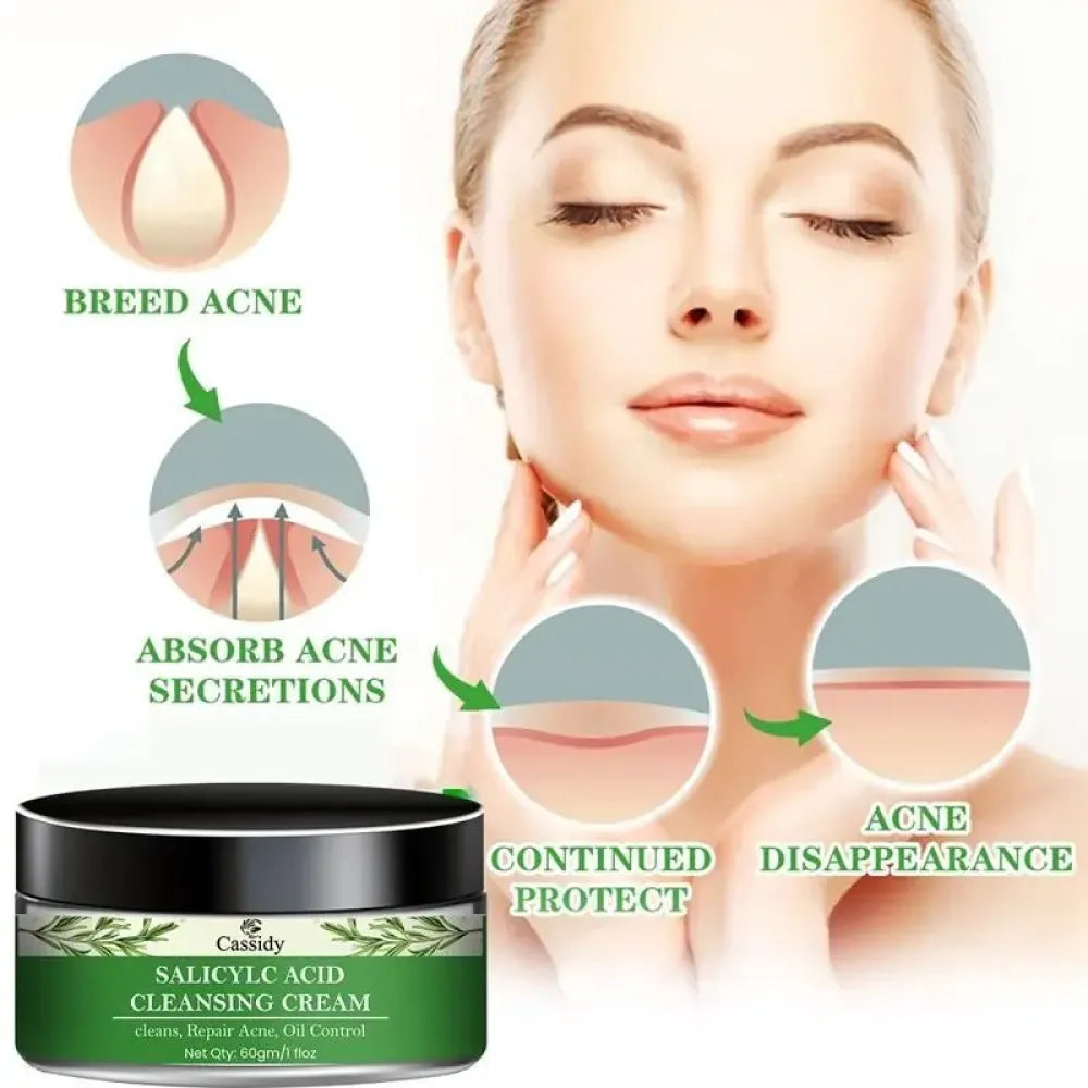 Cassidy salicylc acid cleansing cream