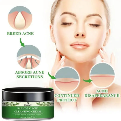 Cassidy salicylc acid cleansing cream
