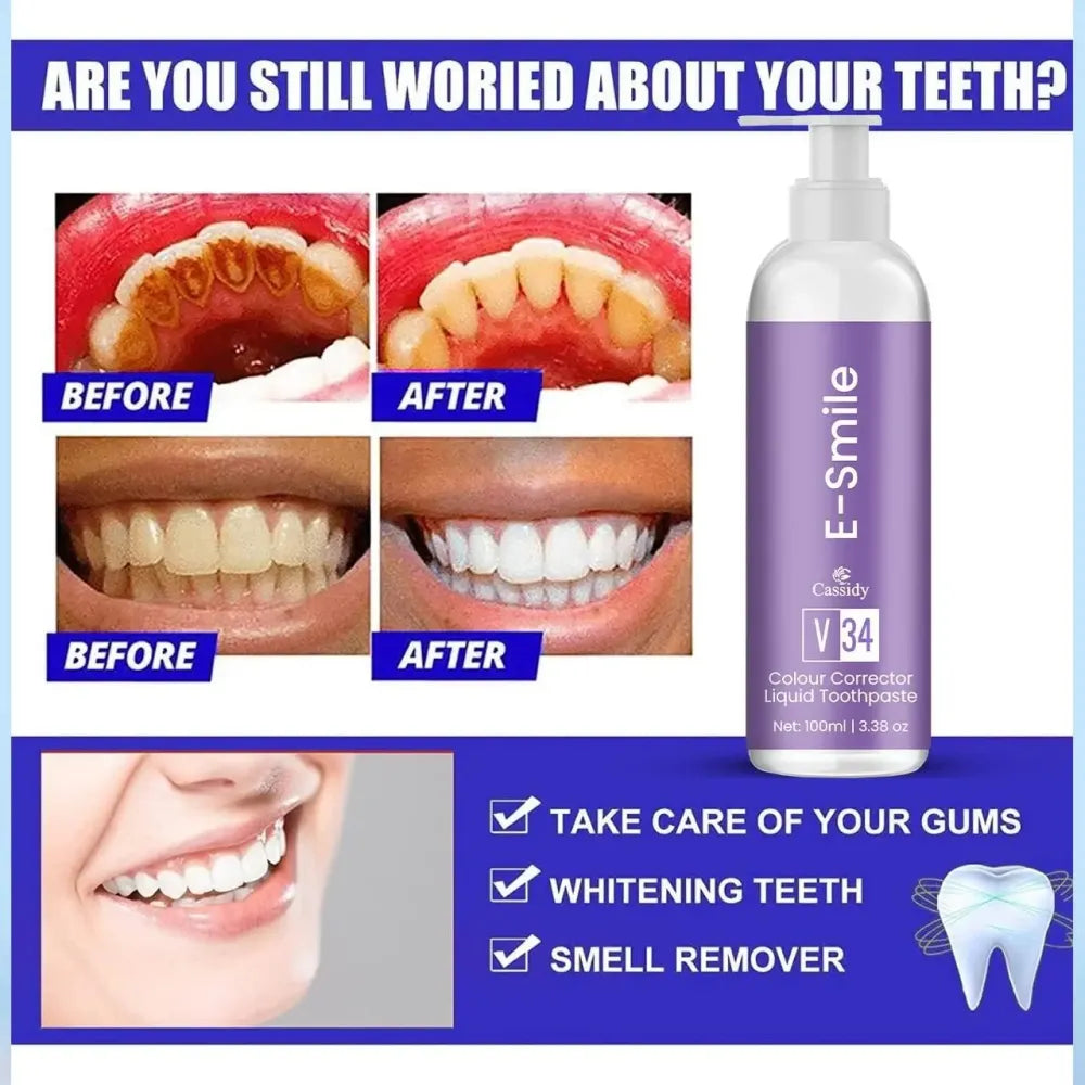 E-smile colour corrector toothpaste – pack of 2