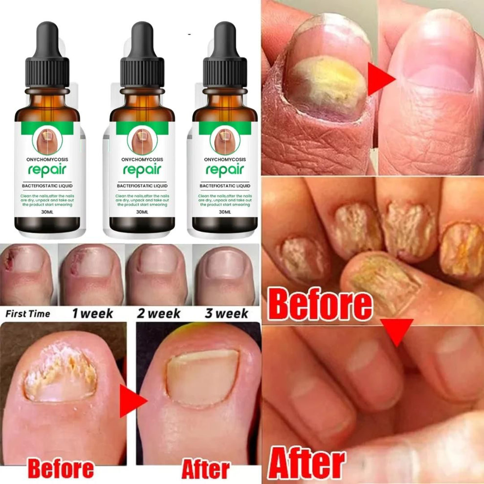 Nails Growth and Repair Oil (Pack Of 2)