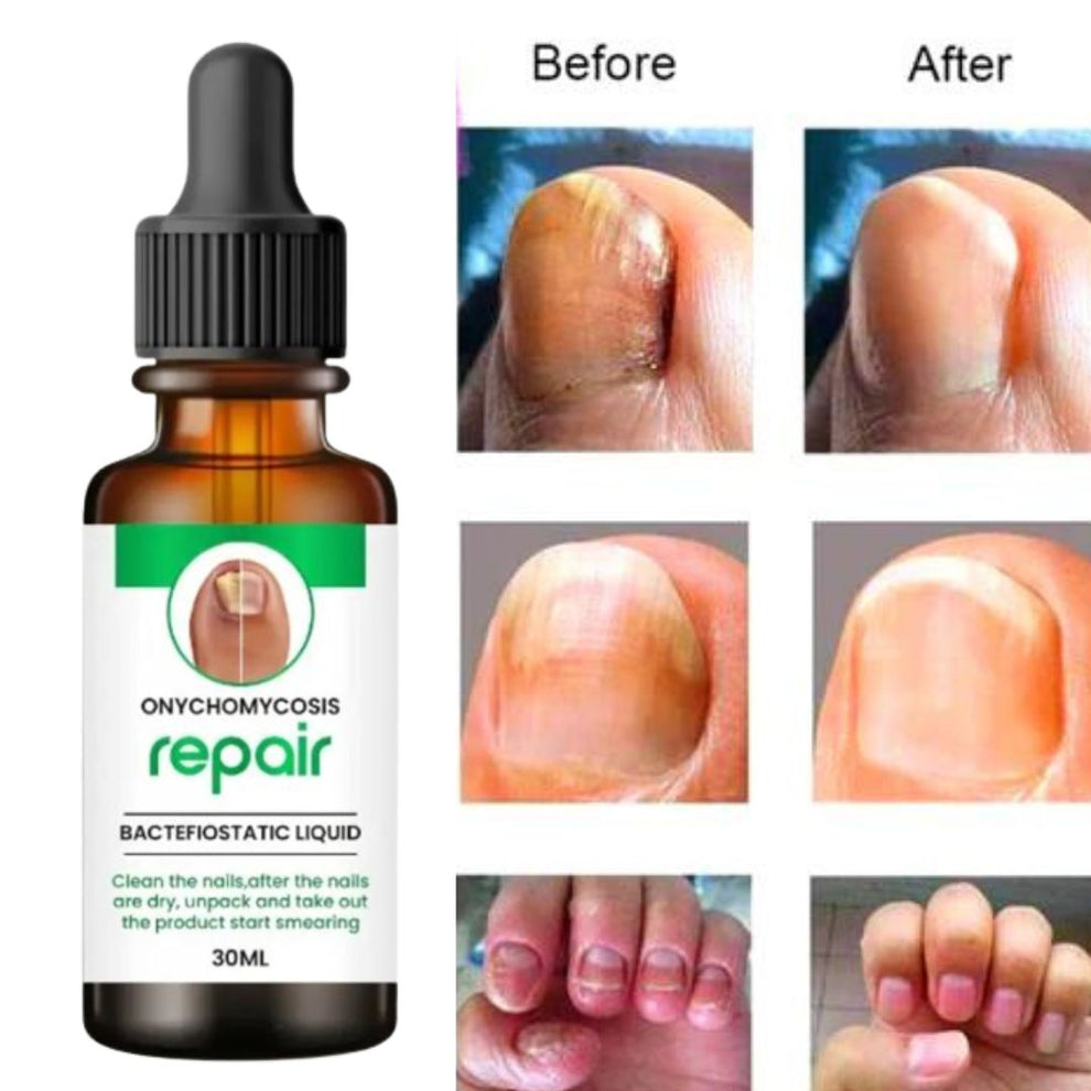 Nails Growth and Repair Oil (Pack Of 2)