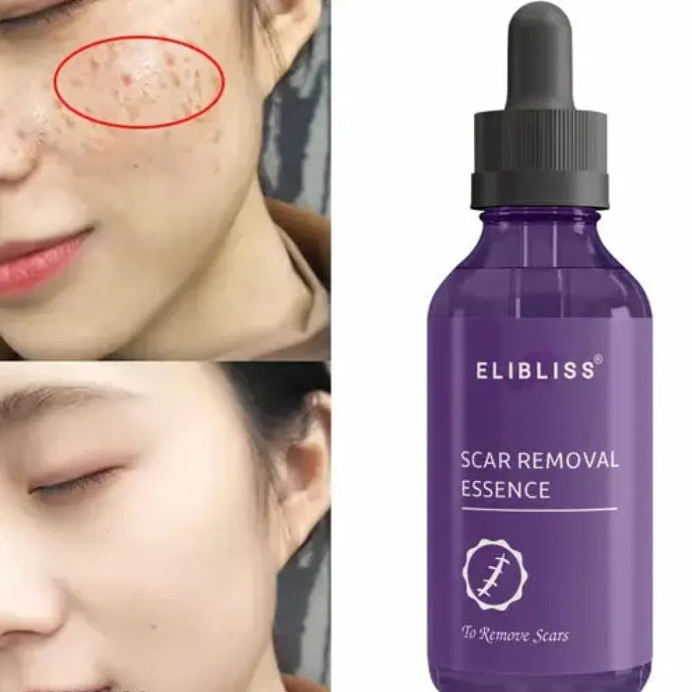 Elibliss scar removal essence 30ml (pack of 2)