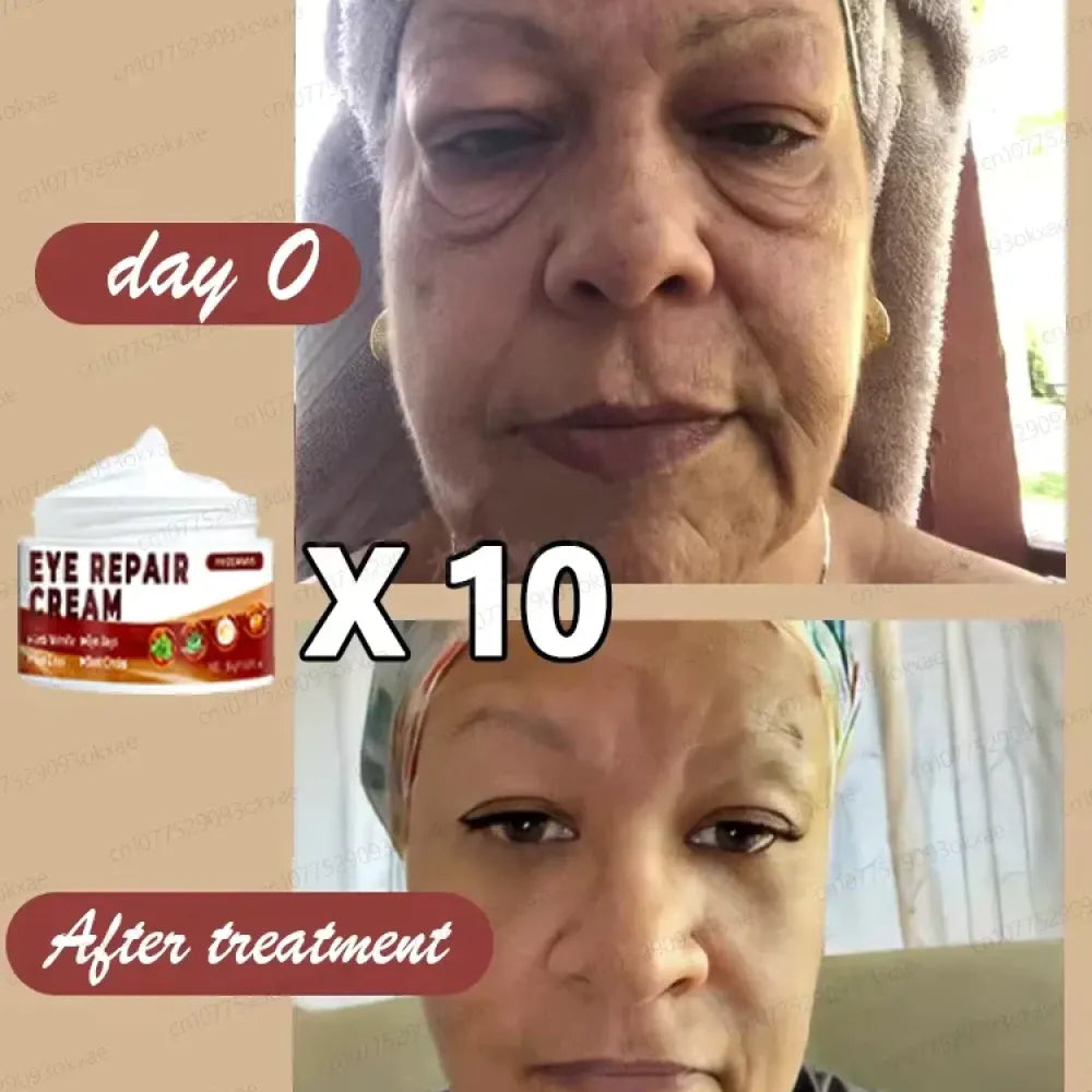 Eye repair cream pack of 2