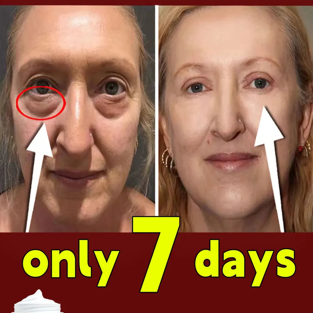 Eye repair cream pack of 2