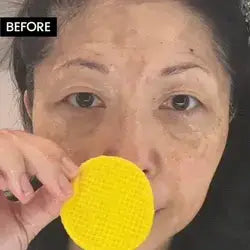Turmeric kojic acid cleansing pads