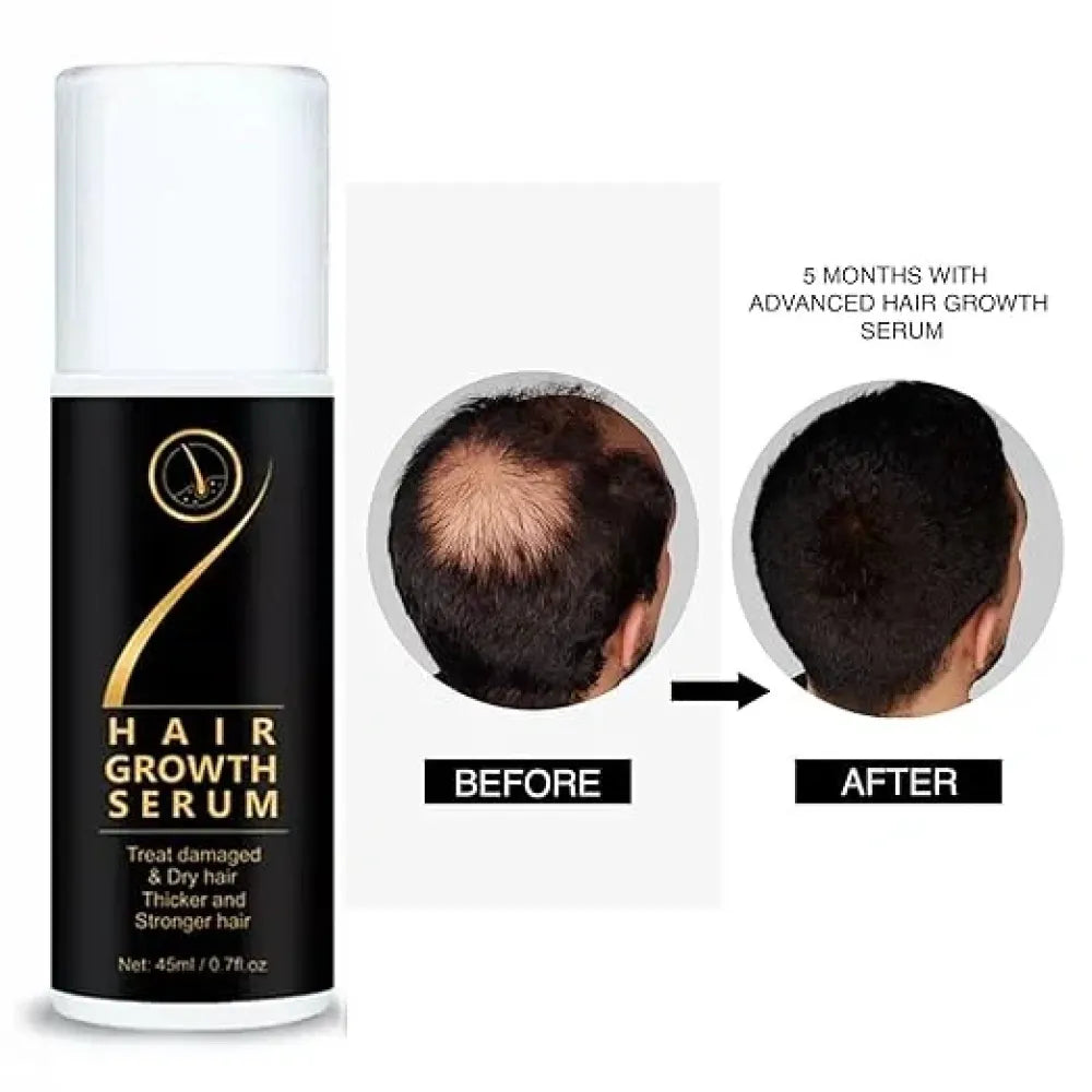 Hair growth serum – 45ml