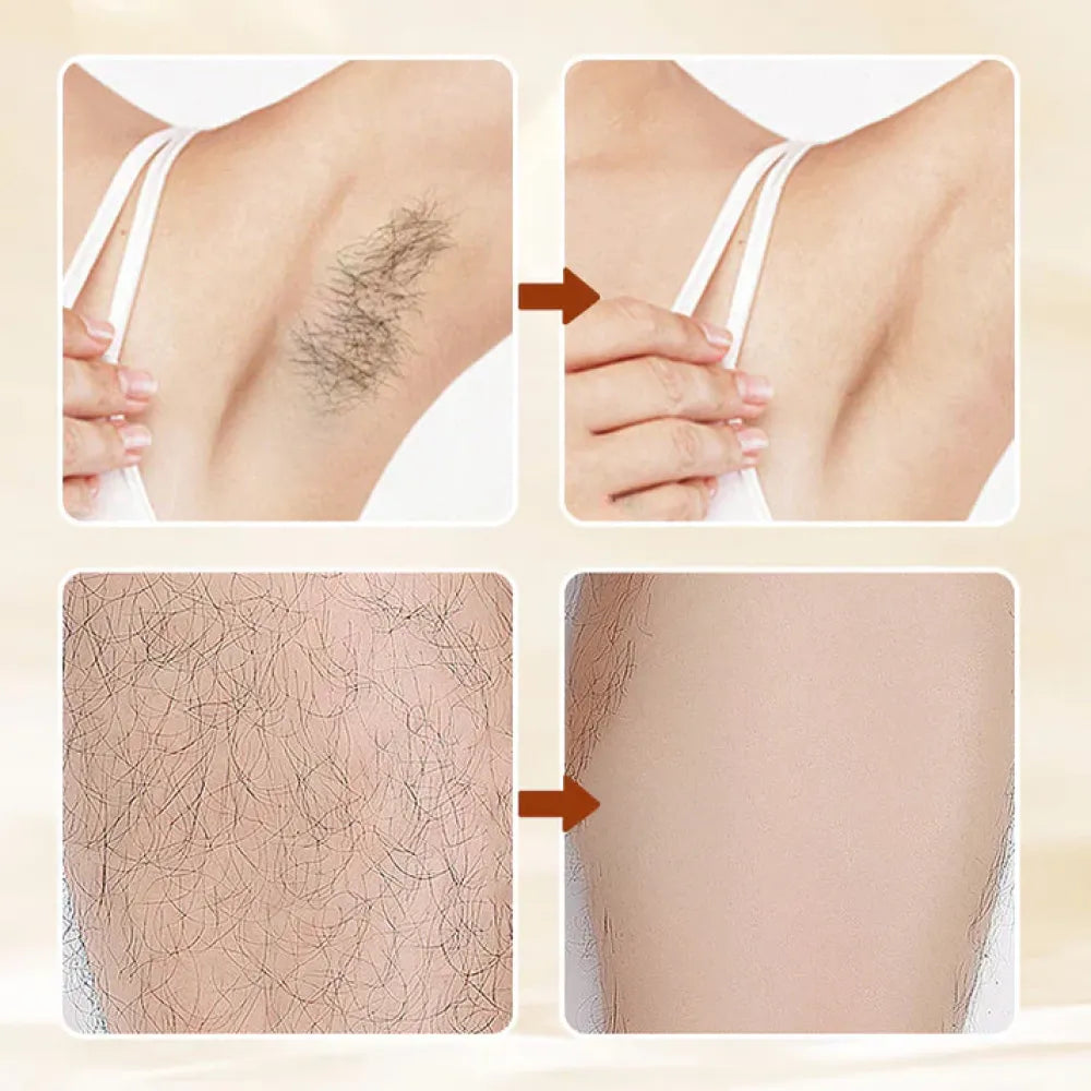 Hair removal cream – 50g
