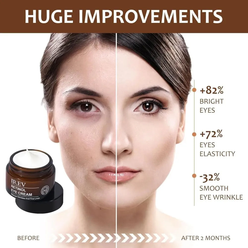 Irev retinol eye cream – 30ml