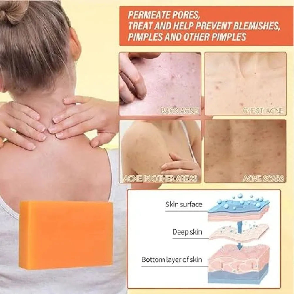 Kojic acid brightening soap – 200g