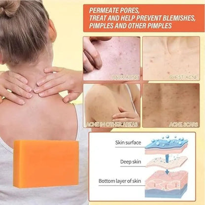 Kojic acid brightening soap – 200g