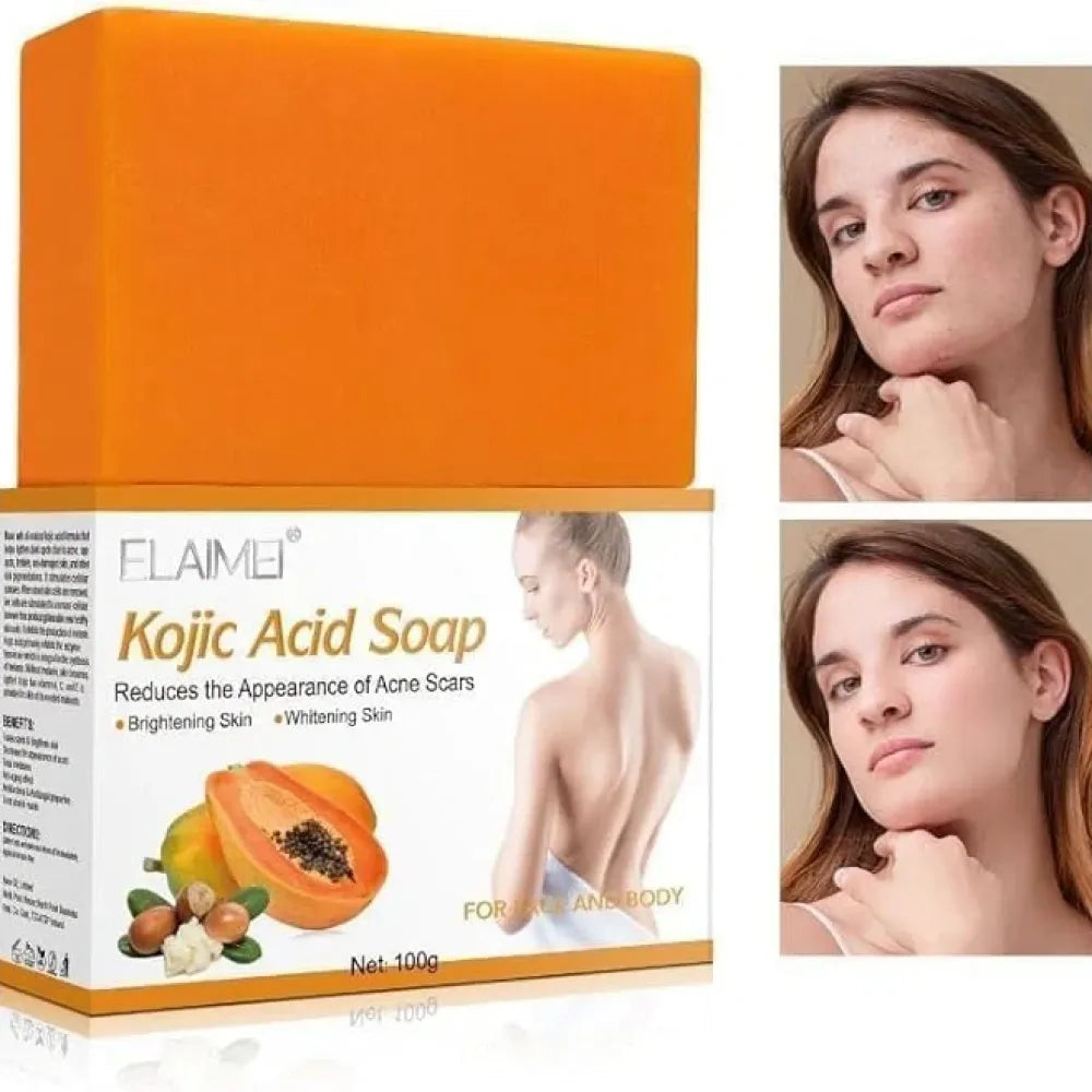 Kojic acid brightening soap – 200g